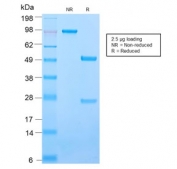 SDS-PAGE analysis of purified, BSA-free recombinant ICAM3 antibody (clone ICAM3/2873R) as confirmation of integrity and purity.
