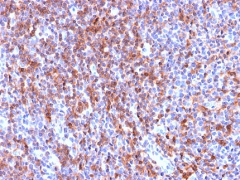IHC staining of FFPE human tonsil tissue with recombinant ICAM3 antibody (clone ICAM3/2873R). HIER: boil tissue sections in pH6, 10mM citrate buffer, for 10-20 min followed by cooling at RT for 20 min.~