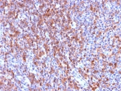 IHC staining of FFPE human tonsil tissue with recombinant ICAM3 antibody (clone ICAM3/2873R). HIER: boil tissue sections in pH6, 10mM citrate buffer, for 10-20 min followed by cooling at RT for 20 min.