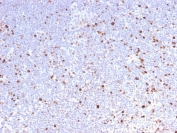 IHC testing of FFPE human lymph node with recombinant MCM7 antibody. Required HIER: boil tissue sections in pH 9 10mM Tris with 1mM EDTA for 10-20 min.