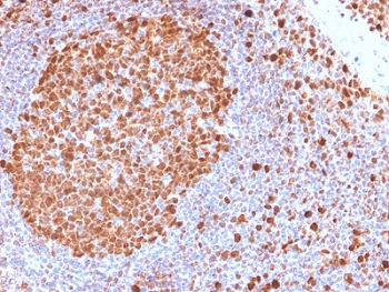 IHC testing of FFPE human tonsil with recombinant MCM7 antibody. Required HIER: boil tissue sections in pH 9 10mM Tris with 1mM EDTA for 10-20 min.~