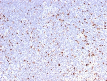IHC testing of FFPE human lymph node with recombinant MCM7 antibody. Required HIER: boil