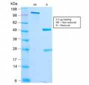 SDS-PAGE analysis of purified, BSA-free recombinant MITF antibody (clone MITF/2987R) as confirmation of integrity and purity.
