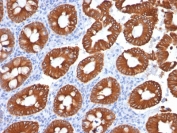 IHC testing of human colon with Cytokeratin 20 antibody (clone KRT20/1991). Required HIER: boil tissue sections in 10mM citrate buffer, pH 6, for 10-20 min followed by cooling at RT for 20 min.