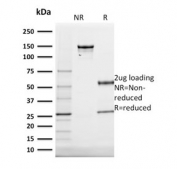 SDS-PAGE analysis of purified, BSA-free Cytokeratin 20 antibody (clone KRT20/1991) as confirmation of integrity and purity.