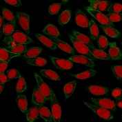 Immunofluorescent staining of human HeLa cells with recombinant Spectrin beta III antibody (green, clone SPTBN2/3142R) and Reddot nuclear stain (red).