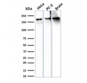 Western blot testing of human HeLa, PC-3 and brain lysate with recombinant Spectrin beta III antibody (clone SPTBN2/3142R). Predicted molecular weight ~246 kDa.