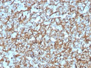 IHC testing of FFPE human pancreas with recombinant Spectrin beta III antibody (clone SPTBN2/3142R). Required HIER: boil tissue sections in 10mM citrate buffer, pH 6, for 10-20 min followed by cooling at RT for 20 min.~