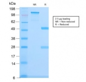 SDS-PAGE analysis of purified, BSA-free recombinant Spectrin beta III antibody (clone SPTBN2/3142R) as confirmation of integrity and purity.