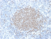 IHC staining of FFPE human lymph node with SULT1E1 antibody. Required HIER: boil tissue sections in pH6, 10mM citrate buffer, for 10-20 min followed by cooling at RT for 20 min.