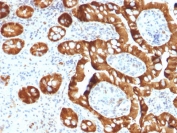 IHC staining of FFPE human small intestine with SULT1E1 antibody. Required HIER: boil tissue sections in pH6, 10mM citrate buffer, for 10-20 min followed by cooling at RT for 20 min.