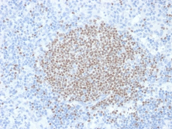 IHC staining of FFPE human lymph node with SULT1E1 an