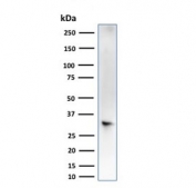 Western blot testing of human liver lysate with SULT1E1 antibody (clone CPTC-SULT1E1-1). Expected molecular weight ~33-35 kDa.