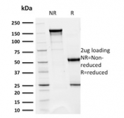 SDS-PAGE analysis of purified, BSA-free CD5 antibody (clone CD5/2418) as confirmation of integrity and purity.