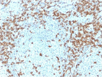 IHC staining of FFPE human tonsil with CD5 antibody (clone CD5/2418). Required HIER: boil tissue sections in 10mM citrate buffer, pH 6, for 10-20 min followed by cooling at RT for 20 min.~