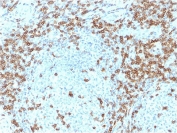 IHC staining of FFPE human tonsil with CD5 antibody (clone CD5/2418). Required HIER: boil tissue sections in 10mM citrate buffer, pH 6, for 10-20 min followed by cooling at RT for 20 min.