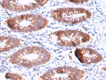 IHC testing of FFPE human colon tissue with recombinant Aurora B antibody (clone AURKB/3121R). HIER: boil tissue sections in pH6, 10mM citrate buffer, for 10-20 min followed by cooling at RT for 20 min.~