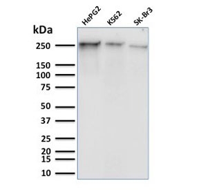 Western blot testing of human HepG2, K562, and SK-BR-3 cell lysate with phospho-RNA polymerase II antibody (clone CTD 8A7). Routinely observed molecular weight: 200-250 kDa.~