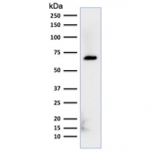 Western blot testing of human HepG2 cell lysate with Albumin antibody (clone ALB/2356). Predicted molecular weigth ~66 kDa.
