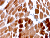 IHC staining of FFPE human cardiac muscle tissue with Sarcomeric Alpha Actinin antibody (clone ACTN2/3292). HIER: boil tissue sections in pH6, 10mM citrate buffer, for 10-20 min and allow to cool before testing.