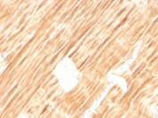 IHC staining of FFPE human skeletal muscle tissue with Sarcomeric Alpha Actinin antibody (clone ACTN2/3292). HIER: boil tissue sections in pH6, 10mM citrate buffer, for 10-20 min and allow to cool before testing.