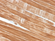 IHC staining of FFPE human skeletal muscle tissue with Sarcomeric Alpha Actinin antibody (clone ACTN2/3292). HIER: boil tissue sections in pH6, 10mM citrate buffer, for 10-20 min and allow to cool before testing.