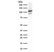 Western blot testing of human skeletal muscle lysate with Sarcomeric Alpha Actinin antibody (clone SAMA-1). Predicted molecular weigth ~103 kDa.