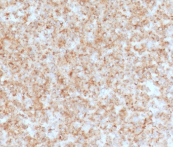 IHC staining of FFPE human spleen with CD137 antibody (clone CDLA137-1). HIER: boil tissue sections in pH9 10mM Tris with 1mM EDTA for 10-20 min and allow to cool before testing.~