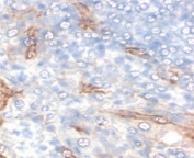 IHC staining of FFPE human tonsil with TIM3 antibody (clone TMDP3-1). HIER: boil tissue sections in pH 9 10mM Tris with 1mM EDTA for 10-20 min and allow to cool before testing.