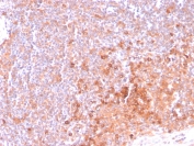 IHC staining of FFPE human tonsil tissue with OX40 antibody (clone OX40/3108). HIER: boil tissue sections in pH6, 10mM citrate buffer, for 10-20 min and allow to cool before testing.