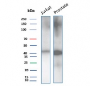 Western blot testing of human Jurkat cell lysate and prostate tissue lysate with CD47 antibody (clone CD47/2937). Expected molecular weight: 35~60 kDa depending on glycosylation level.