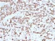 IHC testing of FFPE human pituitary tissue with Prolactin antibody (clone PRL/2910). Required HIER: boil tissue sections in pH6, 10mM citrate buffer, for 10-20 min followed by cooling at RT for 20 min.