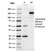 SDS-PAGE analysis of purified, BSA-free Prolactin antibody (clone PRL/2910) as confirmation of integrity and purity.