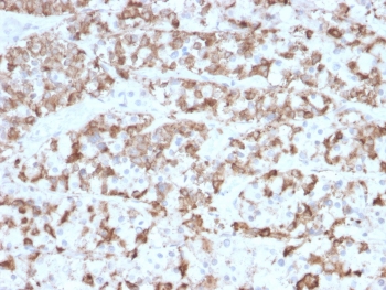 IHC testing of FFPE human pituitary tissue with Prolactin antibody (clone PRL/2910). Required HIER: boil tissue sections in pH6, 10mM citrate buffer, for 10-20 min followed by cooling at RT for 20 min.~