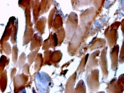 IHC staining of FFPE human cardiac muscle tissue with Sarcomeric Alpha Actinin antibody (clone ACTN2/3293). HIER: boil tissue sections in pH 9 10mM Tris with 1mM EDTA for 10-20 min and allow to cool before testing.