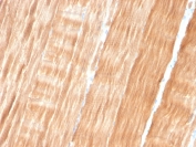 IHC staining of FFPE human skeletal muscle tissue with Sarcomeric Alpha Actinin antibody (clone ACTN2/3293). HIER: boil tissue sections in pH 9 10mM Tris with 1mM EDTA for 10-20 min and allow to cool before testing.