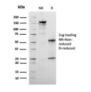 SDS-PAGE analysis of purified, BSA-free Dystrophin antibody (clone DMD/3245) as confirmation of integrity and purity.