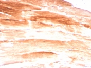IHC staining of FFPE skeletal muscle with Dystrophin antibody (clone DMD/3245). HIER: boil tissue sections in pH6, 10mM citrate buffer, for 10-20 min and allow to cool before testing.