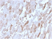 IHC staining of FFPE human cardiac muscle tissue with ACTN2 antibody (clone ACTN2/3291). HIER: boil tissue sections in pH 9 10mM Tris with 1mM EDTA for 10-20 min and allow to cool before testing.