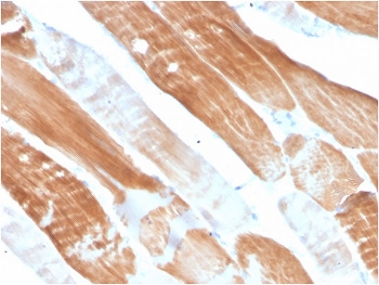 IHC staining of FFPE human skeletal muscle tissue with ACTN2 antibody. HIER: boil tissue sections in pH 9 10mM Tris with 1mM EDTA for 10-20 min and allow to cool before testing.