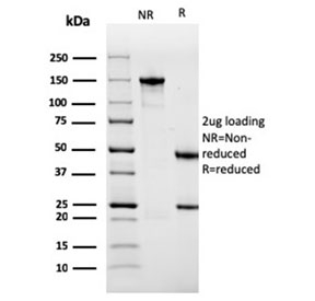 SDS-PAGE analysis of purified, BSA-free ACTN2 antibody as confirmation of integrity and purity.