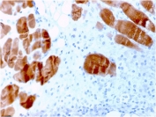 IHC staining of FFPE human skeletal muscle tissue with ACTN2 antibody (clone ACTN2/3291). HIER: boil tissue sections in pH 9 10mM Tris with 1mM EDTA for 10-20 min and allow to cool before testing.