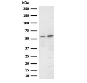 Western blot testing of 1) human Raji and 2) mouse RAW264.7 cell lysate with PD-L2 antibody (clone CDLA273-1). Expected molecular weight: 31-60 kDa depending on glycosylation level.~