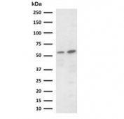 Western blot testing of 1) human Raji and 2) mouse RAW264.7 cell lysate with PD-L2 antibody (clone CDLA273-1). Expected molecular weight: 31-60 kDa depending on glycosylation level.