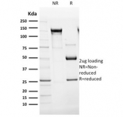 SDS-PAGE analysis of purified, BSA-free Dystrophin antibody (clone DMD/3241) as confirmation of integrity and purity.