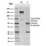 SDS-PAGE analysis of purified, BSA-free Dystrophin antibody (clone DMD/3242) as confirmation of integrity and purity.