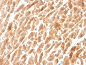IHC staining of FFPE cardiac muscle with Dystrophin antibody (clone DMD/3242). HIER: boil tissue sections in pH 9 10mM Tris with 1mM EDTA for 20 min and allow to cool before testing.