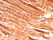 IHC staining of FFPE skeletal muscle with Dystrophin antibody (clone DMD/3242). HIER: boil tissue sections in pH6, 10mM citrate buffer, for 10-20 min and allow to cool before testing.