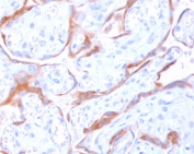 IHC staining of FFPE human placenta with PAPPA antibody (clone IDIP-1). HIER: boil tissue sections in pH6, 10mM citrate buffer, for 10-20 min and allow to cool before testing.