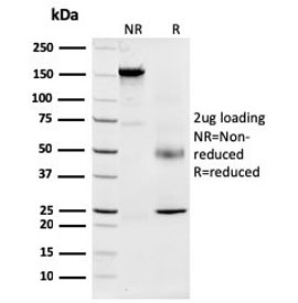 SDS-PAGE analysis of purified, BSA-free Nucleophosmin a